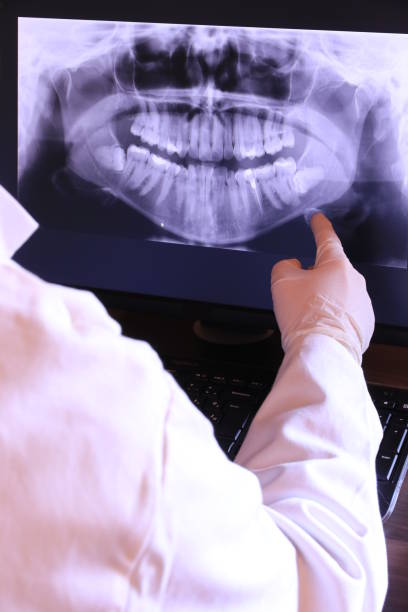Best Emergency Wisdom Tooth Extraction in Forest Park, IL