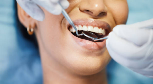 Best Knocked-Out Tooth (Avulsed Tooth) Treatment in Forest Park, IL